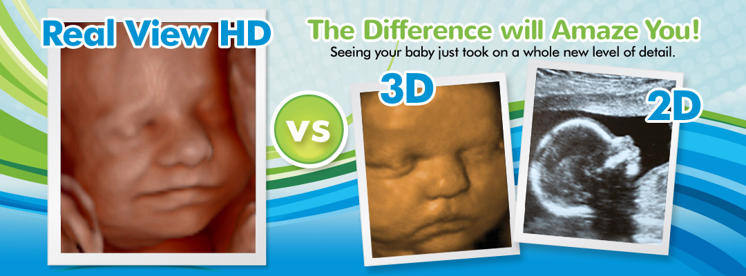 Realview HD ultrasound