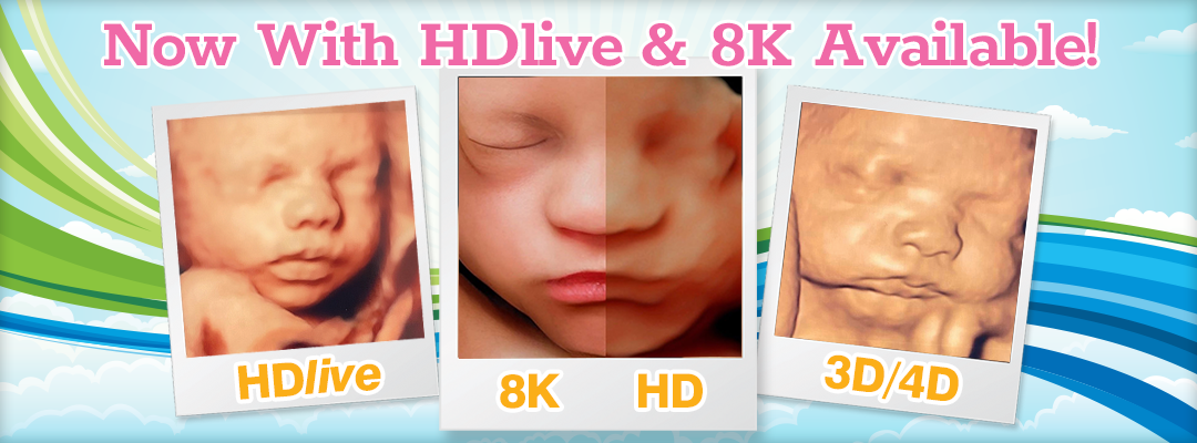 Realview HD ultrasound